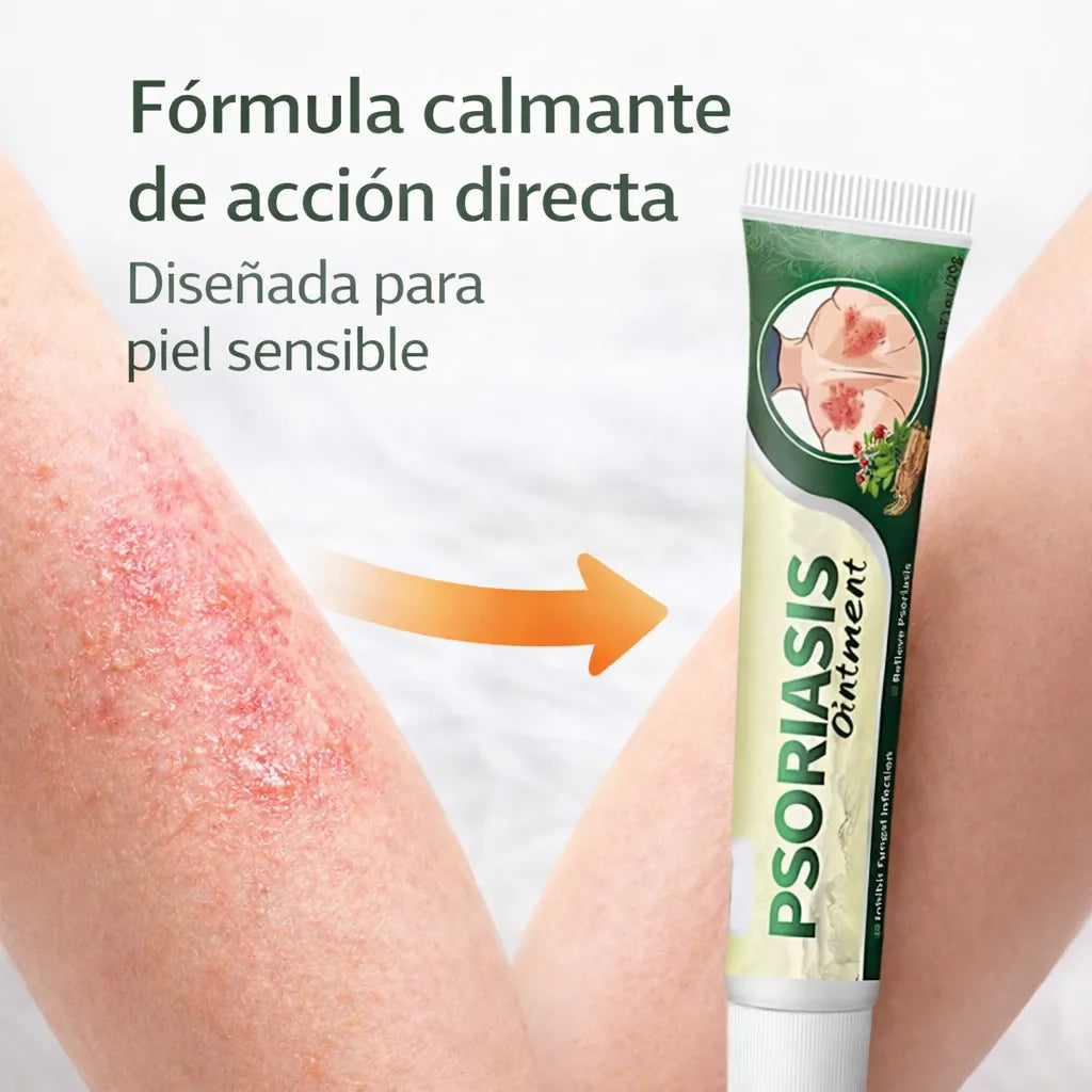ALIVIO NATURAL PARA LA PSORIASIS, ECCEMA Y TIÑA