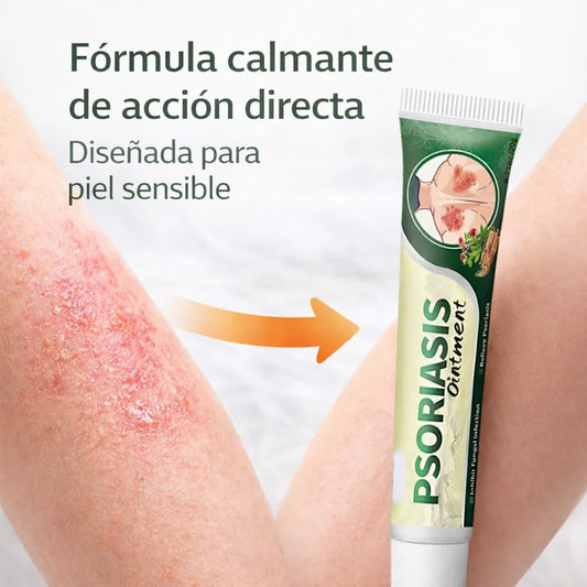 Crema Herbal para la psoriasis