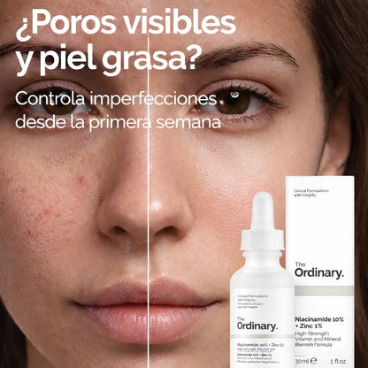 Piel sin imperfecciones con The Ordinary Niacinamide 10% + Zinc 1%