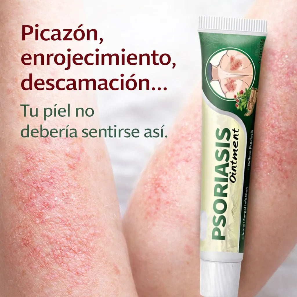 ALIVIO NATURAL PARA LA PSORIASIS, ECCEMA Y TIÑA