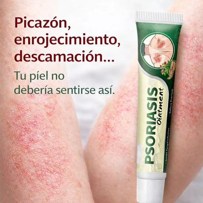 ALIVIO NATURAL PARA LA PSORIASIS, ECCEMA Y TIÑA