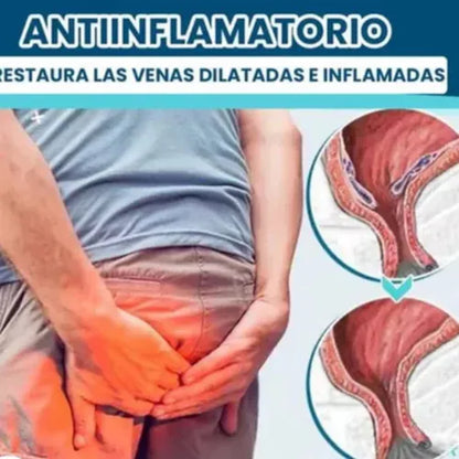 Gel en Spray Anti Hemorroides DICTAMNI
