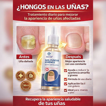 SERUM ANTI HONGOS NAIL FUNGUS